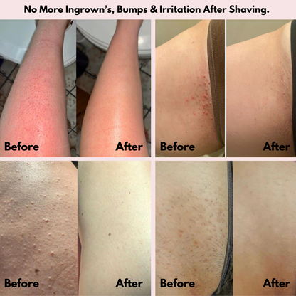 Zylla® SmoothShave Razor